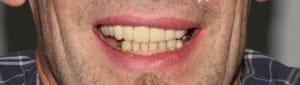 Img 2170 sourire osauzs - Eugenol