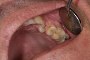 Img 2252 seie9t - Eugenol