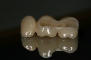 Img 2392 t6i3jf - Eugenol