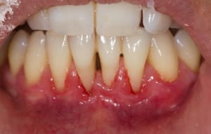 Img 2397 ktes4t - Eugenol