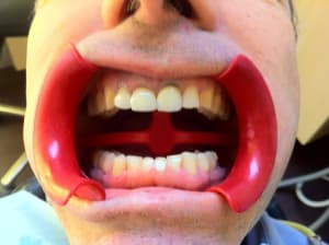 Img 2401 prfqd5 - Eugenol