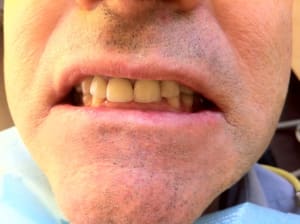 Img 2403 a7ogkg - Eugenol