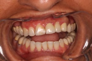 Img 2446 ohxd9q - Eugenol