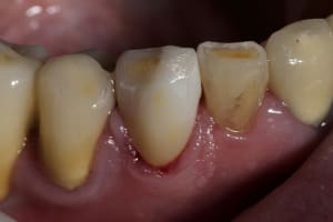 Img 2519 c9mcqw - Eugenol