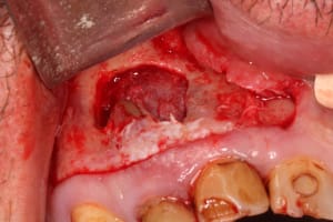 Img 2715 hlbjdi - Eugenol