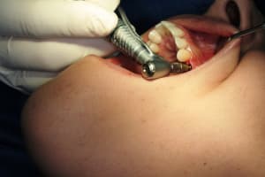 Img 2733 t01340 - Eugenol