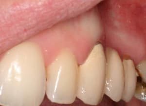Img 2751 h7tcri - Eugenol