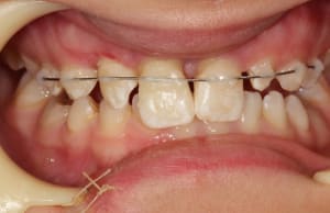 Img 2787 j0scqr - Eugenol