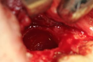 Img 2855 x3man7 - Eugenol