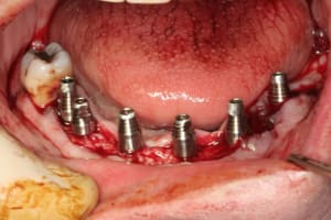 Img 3004 vwwcfp - Eugenol