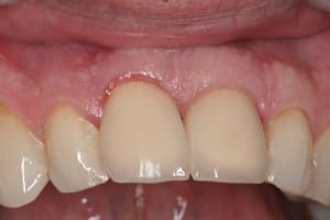 Img 3109 susrjd - Eugenol