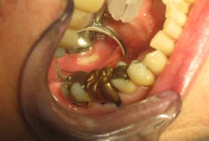 Img 3113 ys8bou - Eugenol