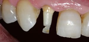 Img 3165 zugndi - Eugenol