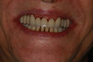 Img 3426 cq9h3l - Eugenol