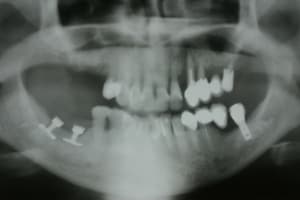 Img 3455 qfe4ik - Eugenol
