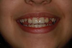 Img 3539 pybfw1 - Eugenol