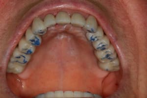 Img 3582 vqzsho - Eugenol