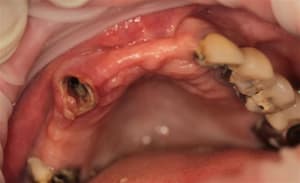 Img 3719 vcg9kg - Eugenol