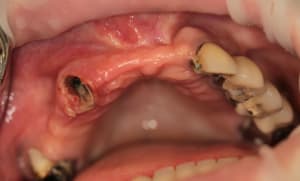 Img 3722 pk6ihe - Eugenol