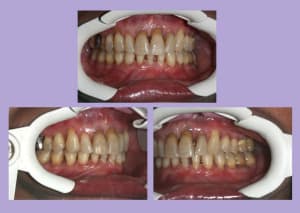 Img 3 ozran6 - Eugenol