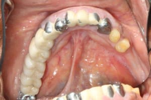Img 4243 pxprou - Eugenol
