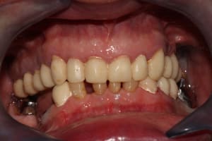 Img 4355 n1s8zz - Eugenol