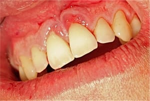 Img 4460 fm8xpq - Eugenol