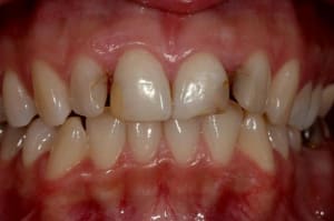 Img 4652 custom vruc1q - Eugenol