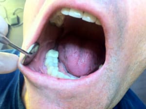 Img 4719 m0qhpg - Eugenol