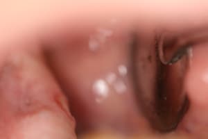 Img 4725 hv1rac - Eugenol