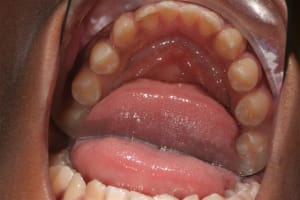 Img 4835  small  gyu6k3 - Eugenol