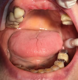 Img 5012 ev8xzq - Eugenol