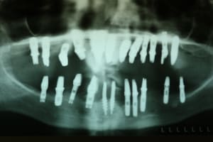 Img 5169 g5sqqd - Eugenol
