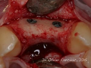 Img 5649 u9dro5 - Eugenol