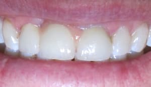 Img 5815 gymgib - Eugenol