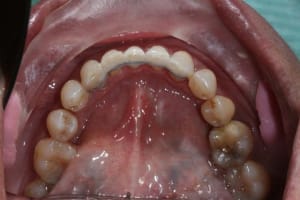 Img 5 llw3xu - Eugenol