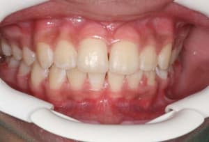 Img 5 z8ak0k - Eugenol