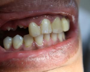 Img 6355 pbfqus - Eugenol