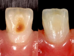 Img 6386  copier  sdwcn2 - Eugenol