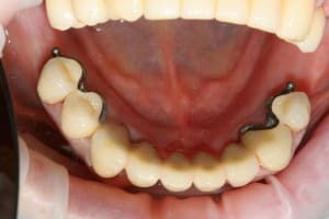 Img 6629copie q1wafq - Eugenol