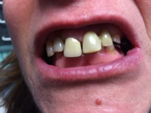 Img 6776 lf80pf - Eugenol