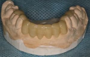 Img 7045 hbqtm7 - Eugenol