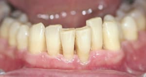 Img 7601 vwkmef - Eugenol