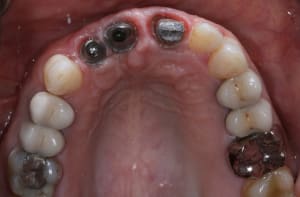 Img 7626 pkwjno - Eugenol