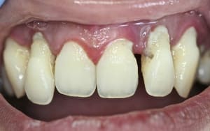 Img 7681 eyeuir - Eugenol