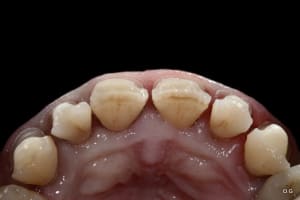 Img 7737 qlysui - Eugenol