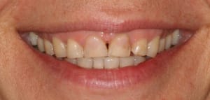 Img 7800 infixj - Eugenol
