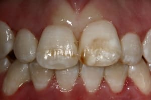 Img 8715 scsbd3 - Eugenol