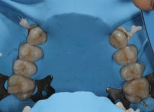 Img 8754 a0po03 - Eugenol