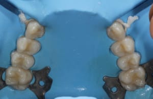 Img 8755 qgsxwt - Eugenol